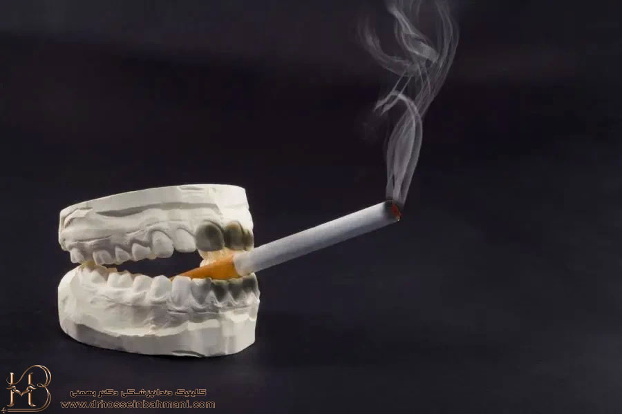 تاثير سيگار بر دندان 