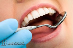 انجام کامپوزیت دندان توسط پزشک مجرب در میدان ونک
