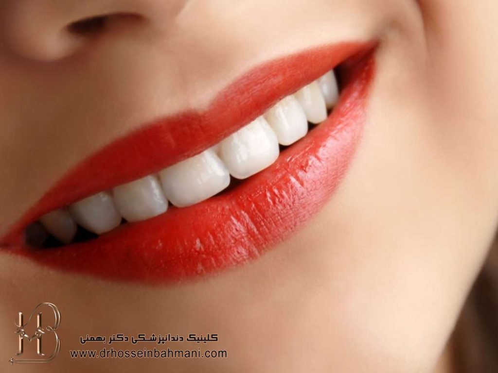 بهترین دندانپزشکی زیبایی در منطقه یک تهران