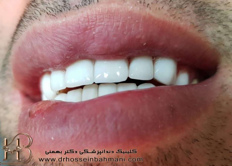 دندانپزشکی بازیگران معروف