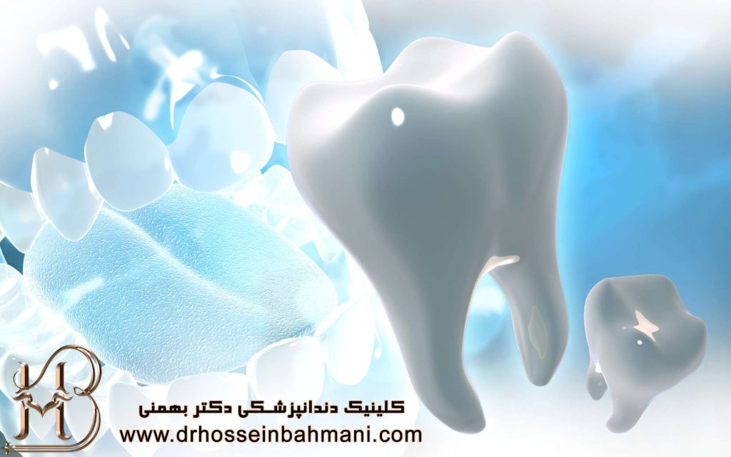 جلوگیری از پوسیدگی با سیلانت دندان
