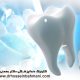 جلوگیری از پوسیدگی با سیلانت دندان
