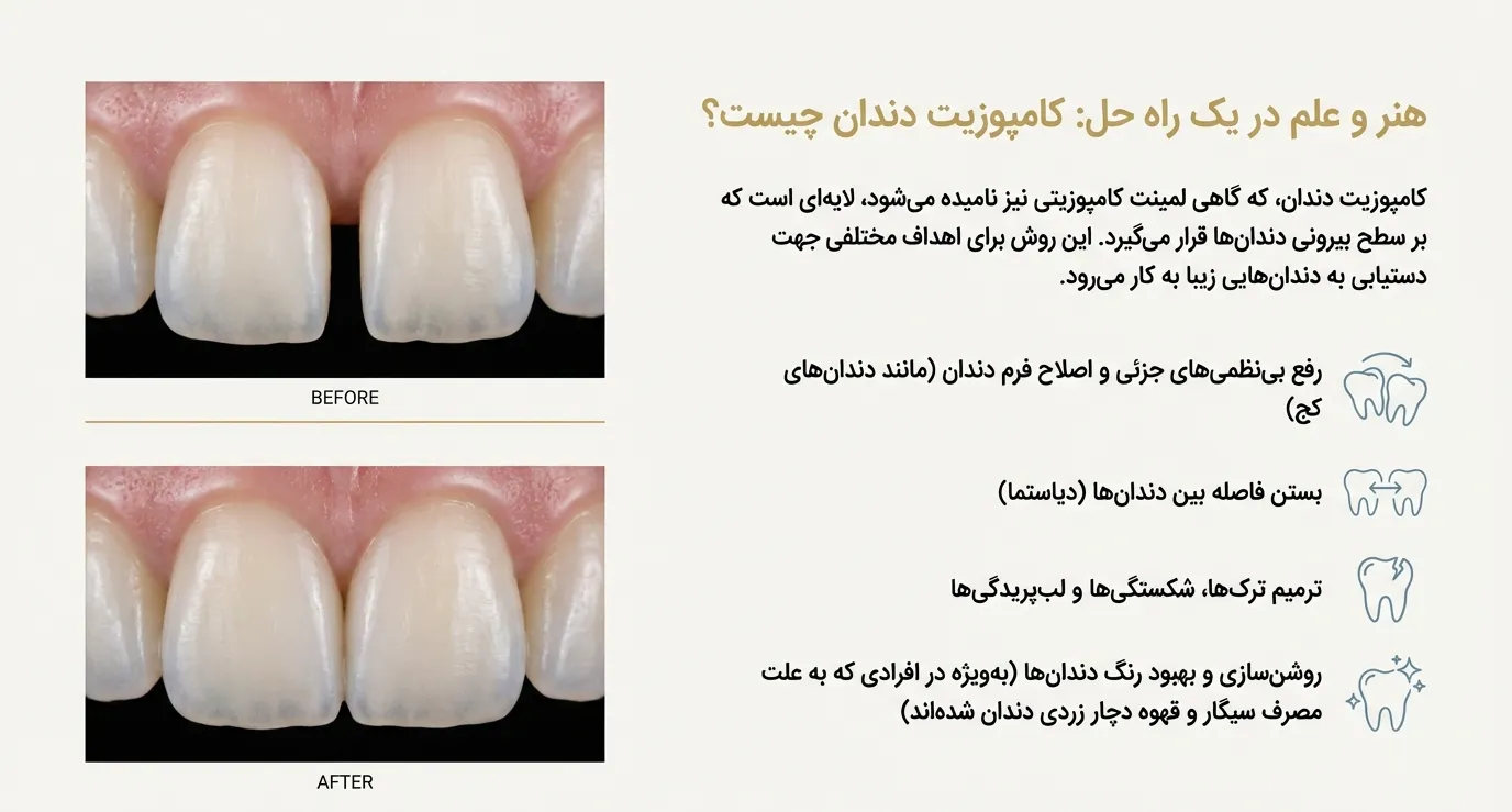 کامپوزیت دندان آلمانی