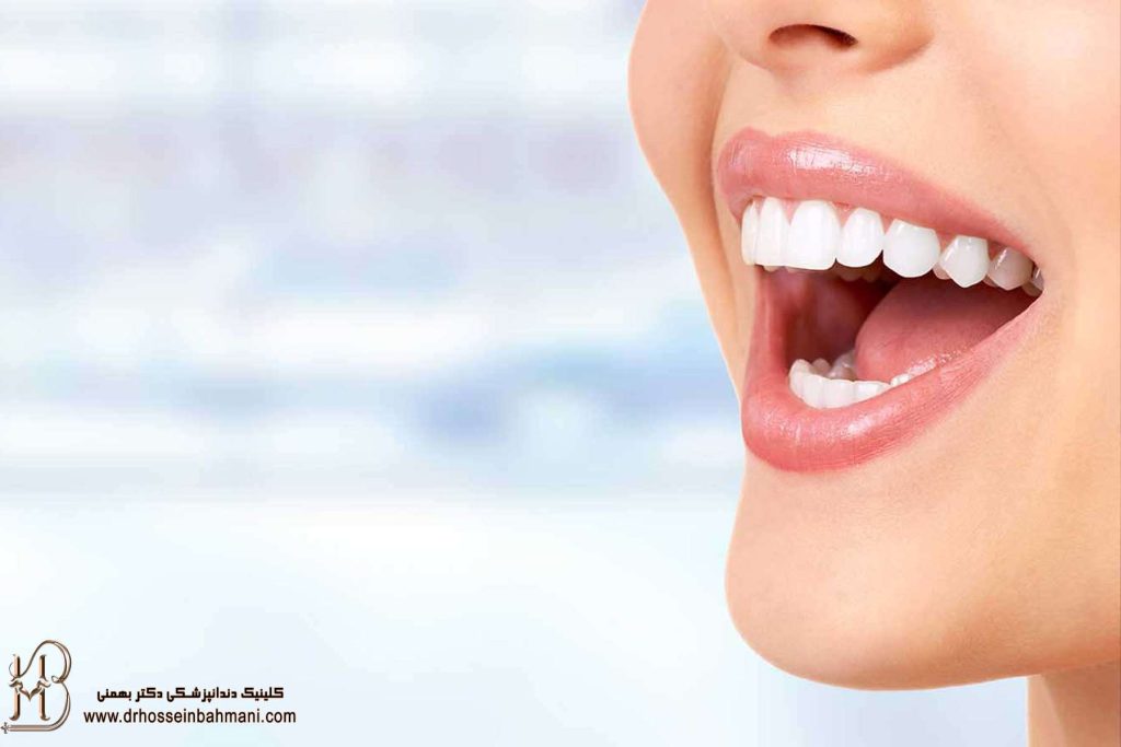 کلینیک دندانپزشکی طراحی لبخند در شمال تهران