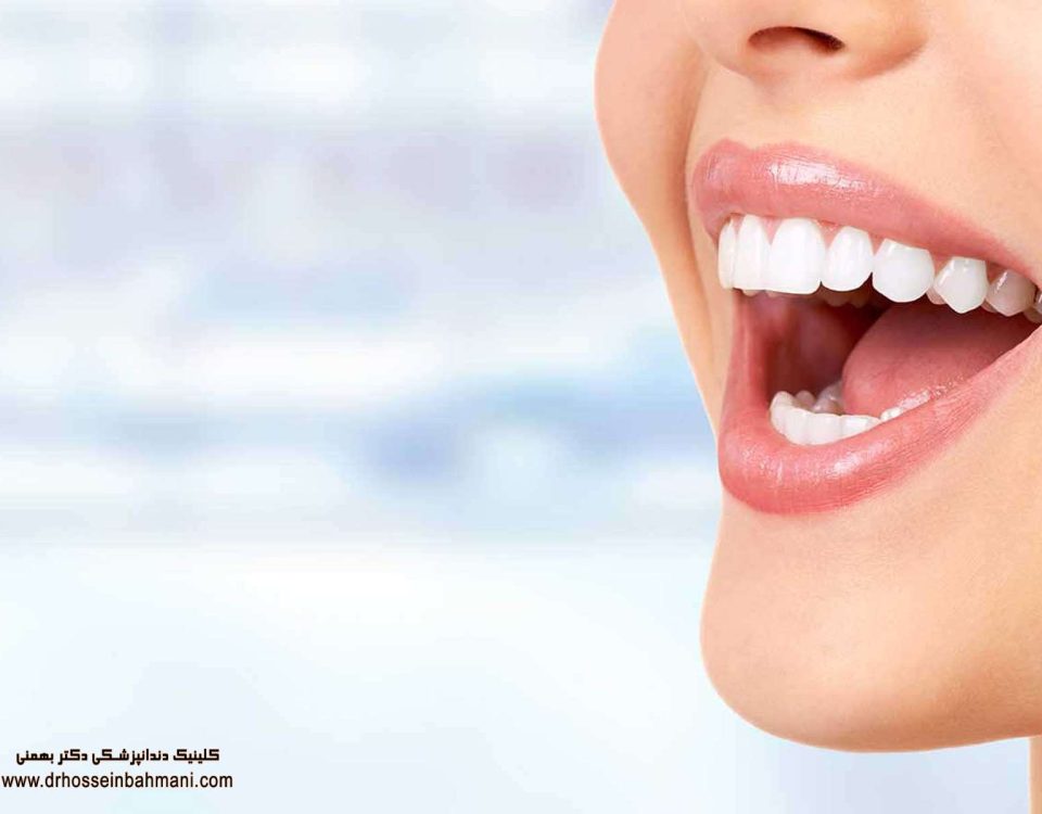 کلینیک دندانپزشکی طراحی لبخند در شمال تهران