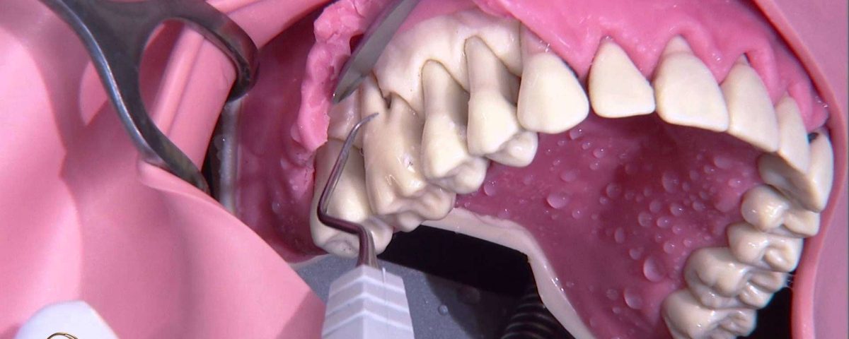 پریو دندان