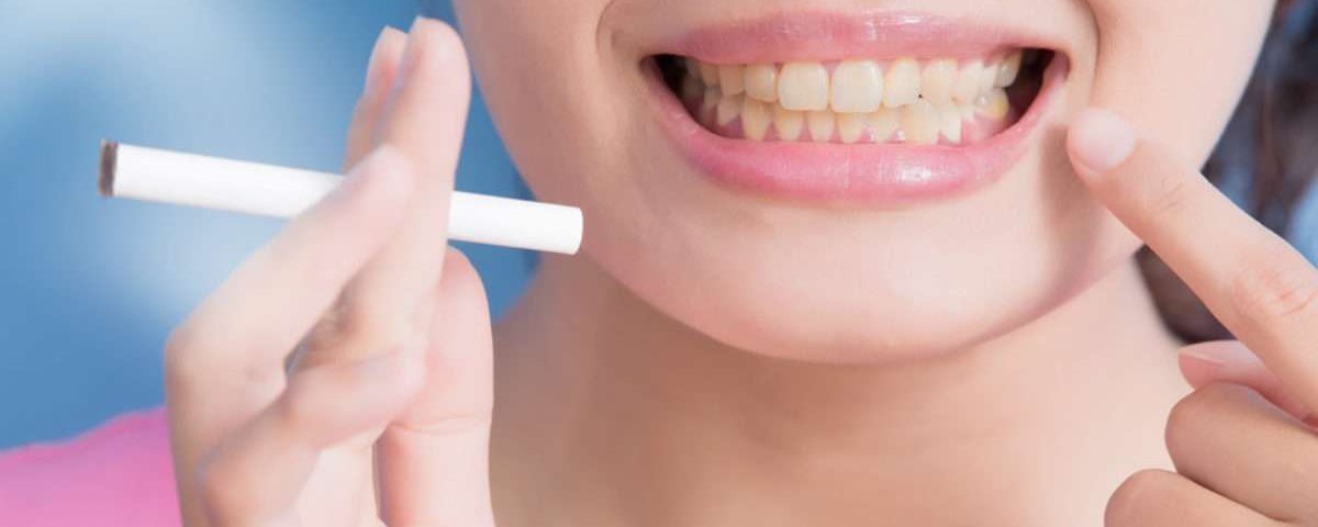 جرم گیری دندان افراد سیگاری