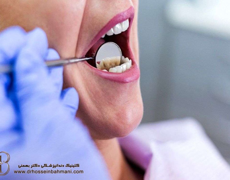 هنرمند دندانپزشکی دکتر حسین بهمنی