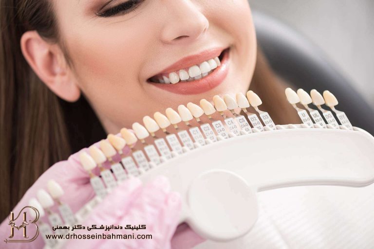 راهنمای انتخاب بهترین رنگ لمینت