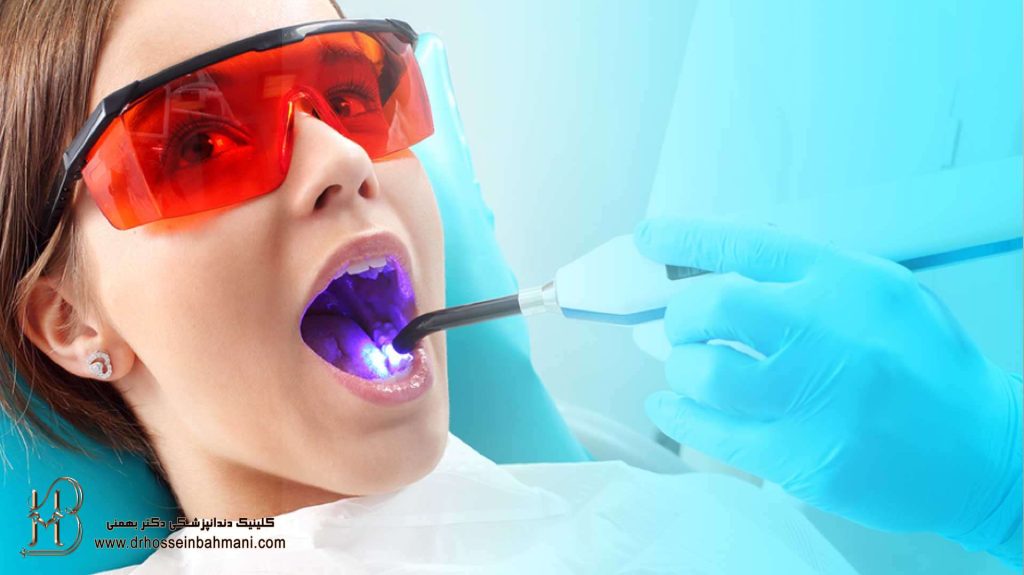 کشیدن دندان با لیزر