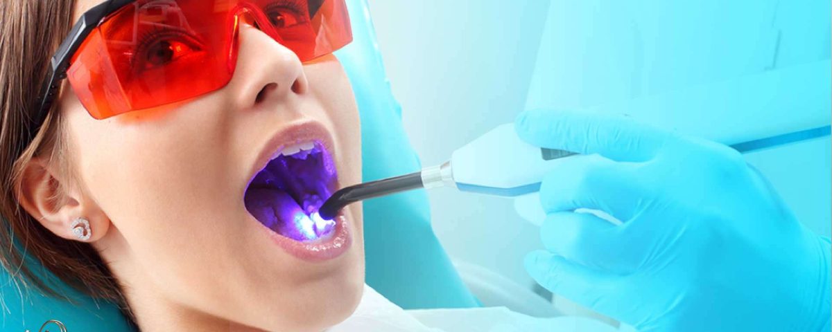 کشیدن دندان با لیزر