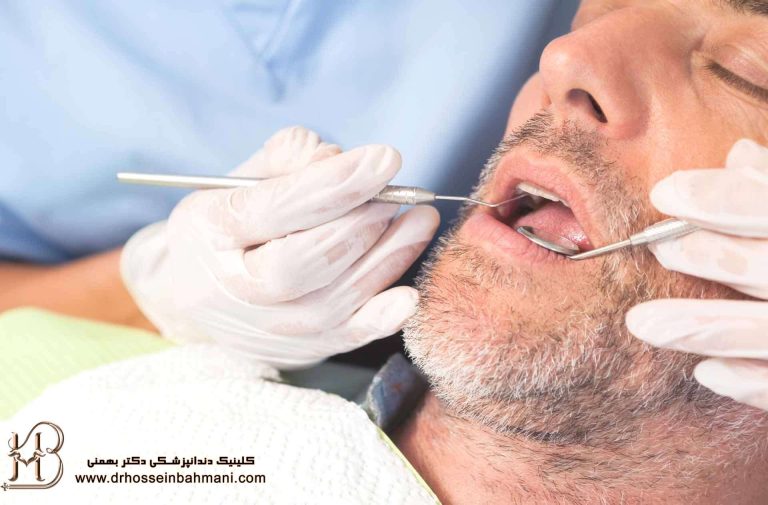 مزایا و معایب سدیشن