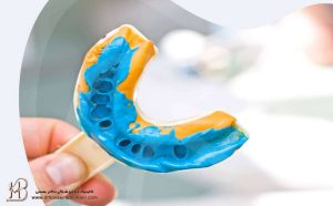 نحوه قالبگیری دندانپزشکی برای ارتودنسی