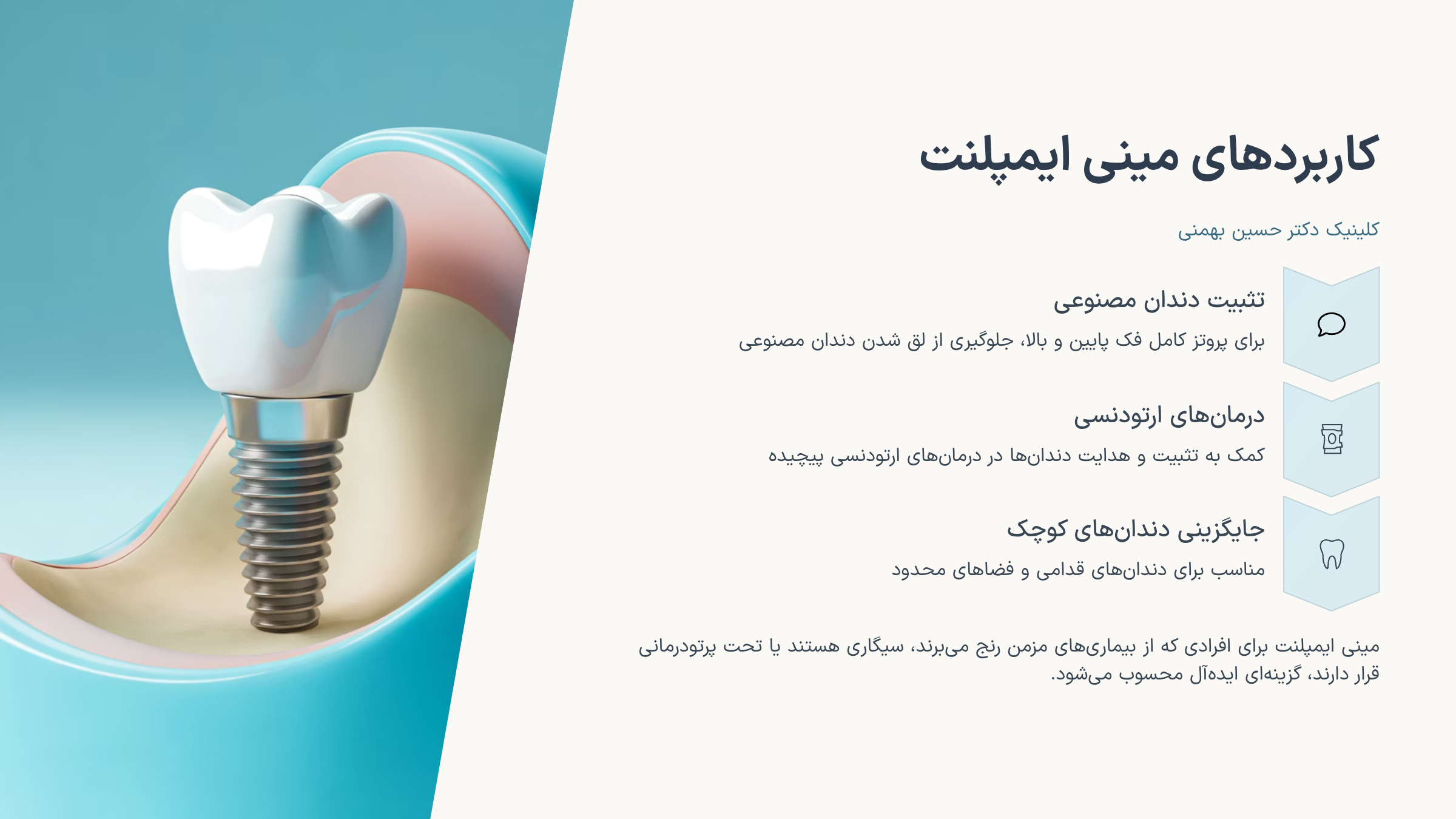 مینی ایمپلنت دندان
