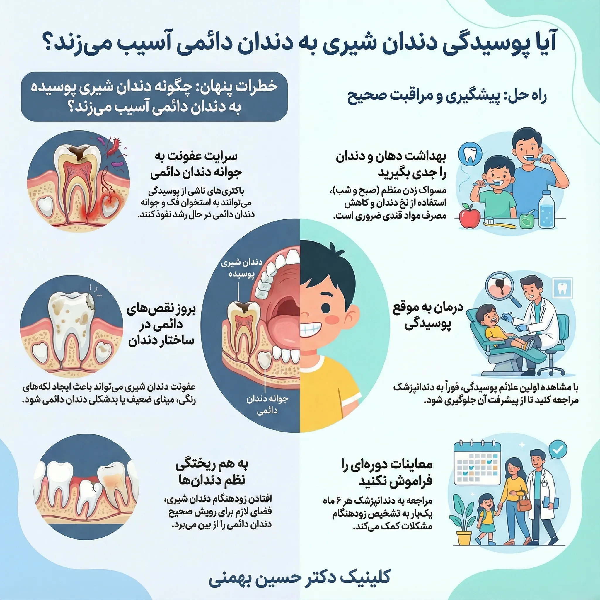 تاثیر پوسیدگی دندان شیری روی دندان‌های دائمی