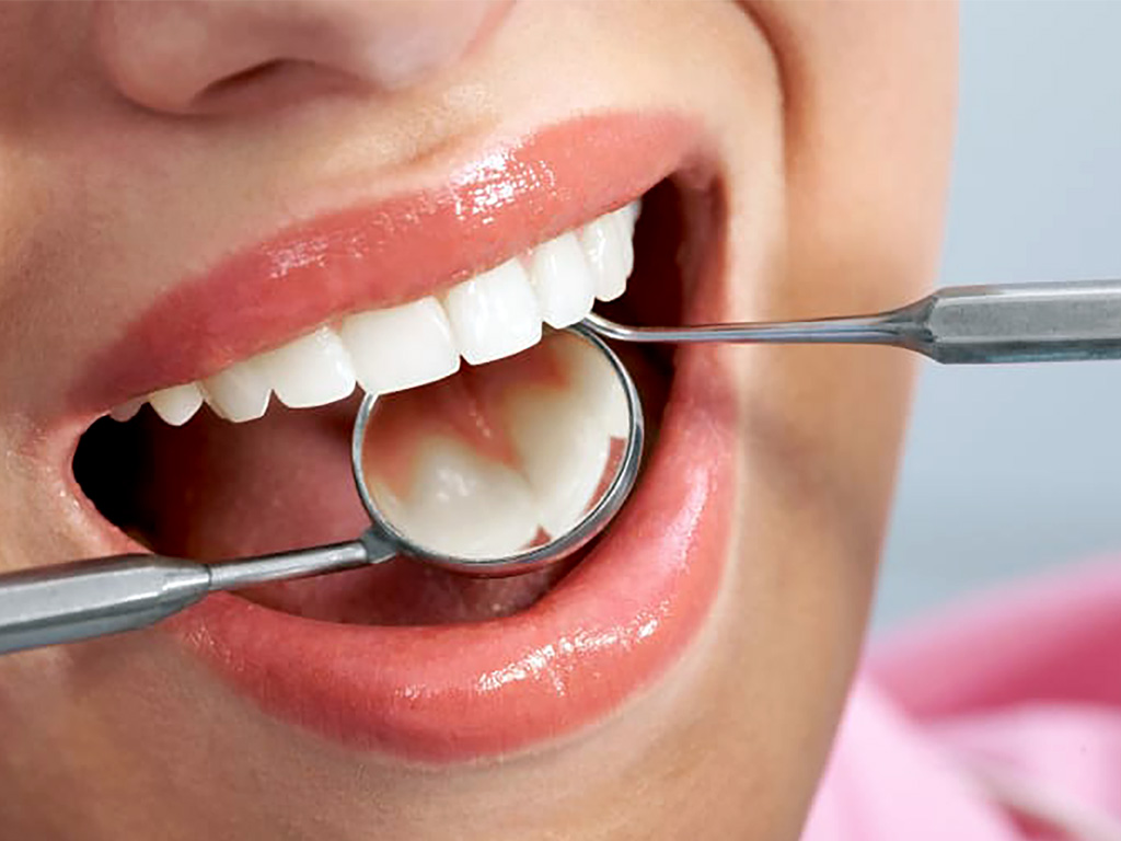 معرفی خدمات کامپوزیت دندان