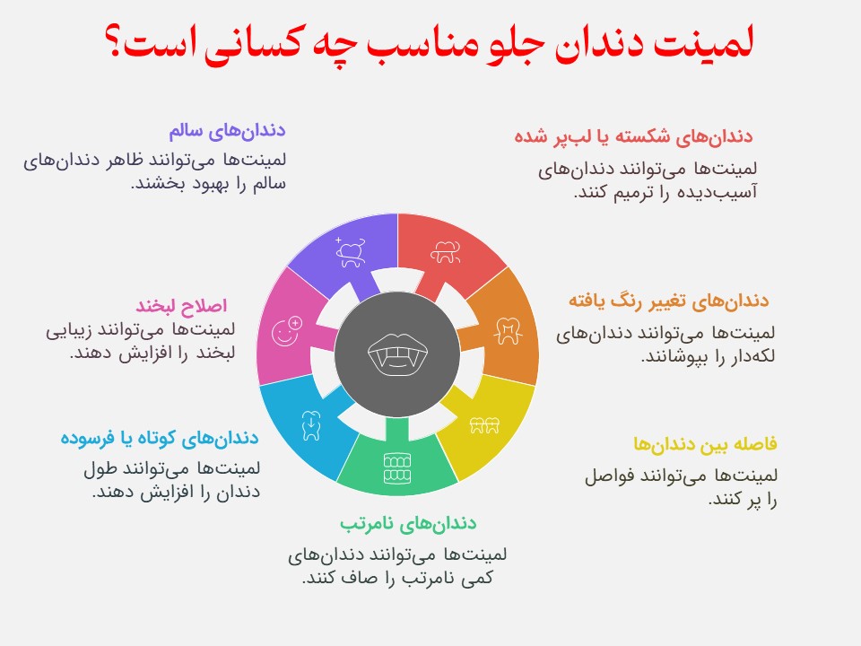 لمینت دندان جلو مناسب چه کسانی است؟