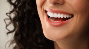 لمینت سرامیکی