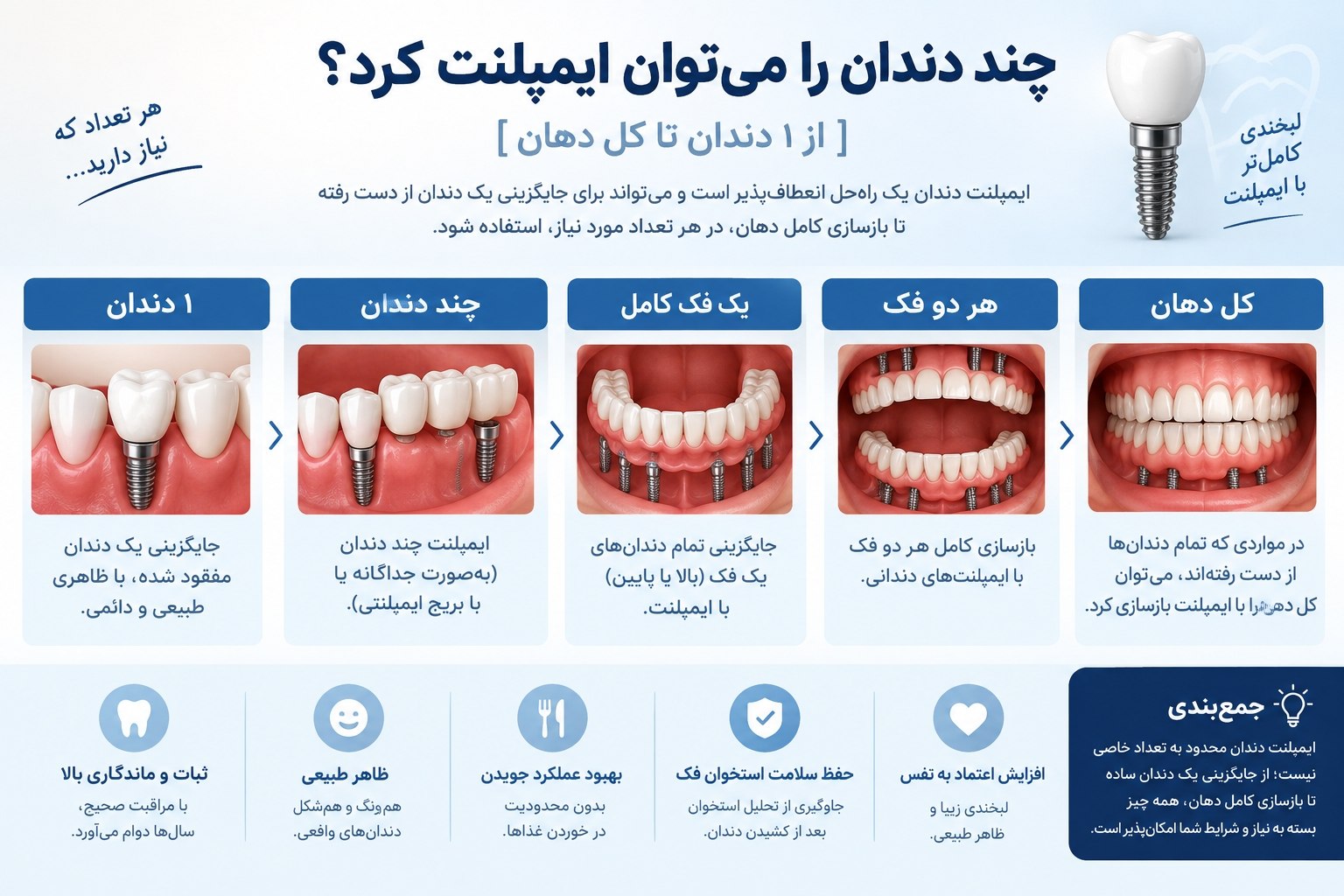 چند دندان را می توان لمینت کرد؟